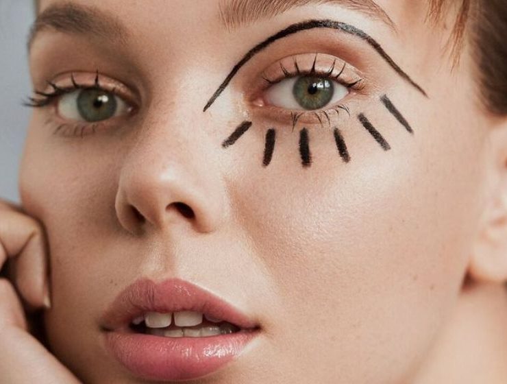 BL&Eacute;PHAROPLASTIE : CE QU&rsquo;IL FAUT SAVOIR AVANT DE SE LANCER