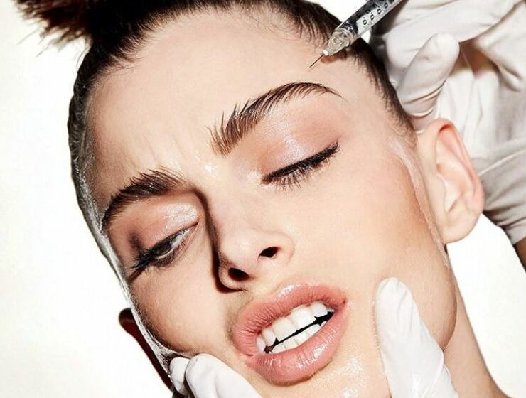 M&Eacute;SOBOTOX : LA TECHNIQUE QUI FAIT DE L&rsquo;OMBRE AU BOTOX