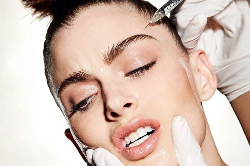 MÉSOBOTOX : LA TECHNIQUE QUI FAIT DE L’OMBRE AU BOTOX
